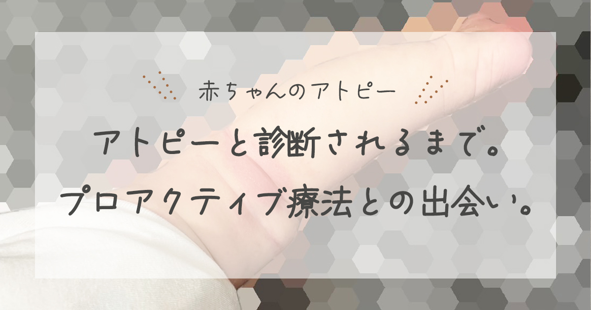 アトピーと診断されるまで。プロアクティブ療法との出会い。